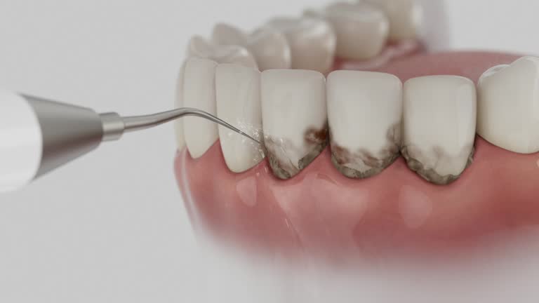 Trusted Emergency Dentist service in Williamston, SC - Dentist Open Now